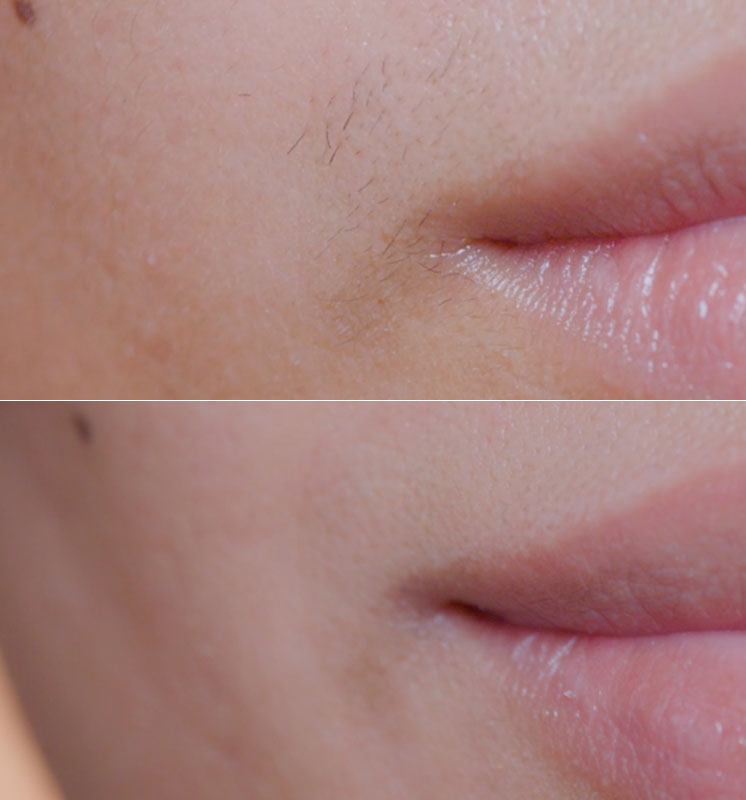 Before and After